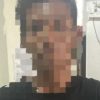 Terbakar Cemburu, FM (26) Aniaya Istrinya SM(21) dengan Sajam, Korban Alami 15 Luka Tusukan